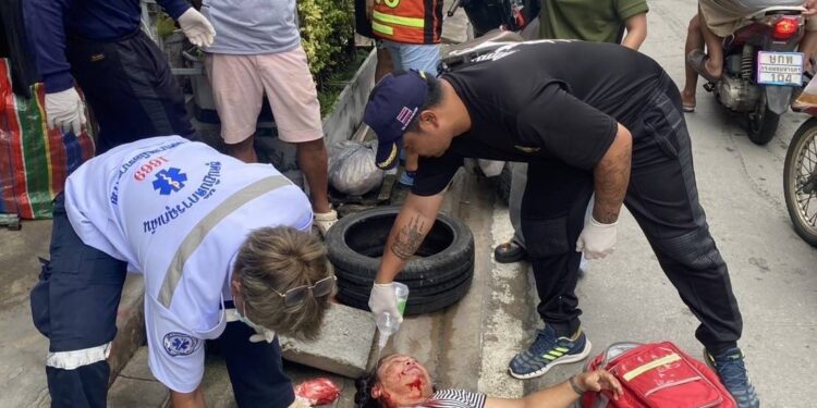 นนทบุรี คลิป พนักงานโรงแรม ผวาถูกเจ้าของตลาดรุมทำร้าย3ต่อ1 ศีรษะแตก สาเหตุแค่จอดรถ