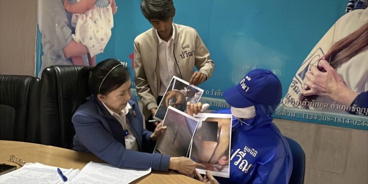 ปทุมธานี สาวหอบร่างแผลเหอวะหวะร้อง”ปวีณา”ถูกอดีตสามีดักใช้มีดแทงกรีดหน้าขอดำเนินคดีให้ถึงที่สุด