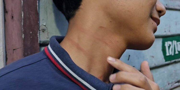 นนทบุรี เจ้าอาวาสโร่แจ้งความ ถูกเด็ก 16 ปี ทำร้ายคิ้วแตก หน้าตาปูดบวม หลังห้ามขุดไส้เดือนในวัด