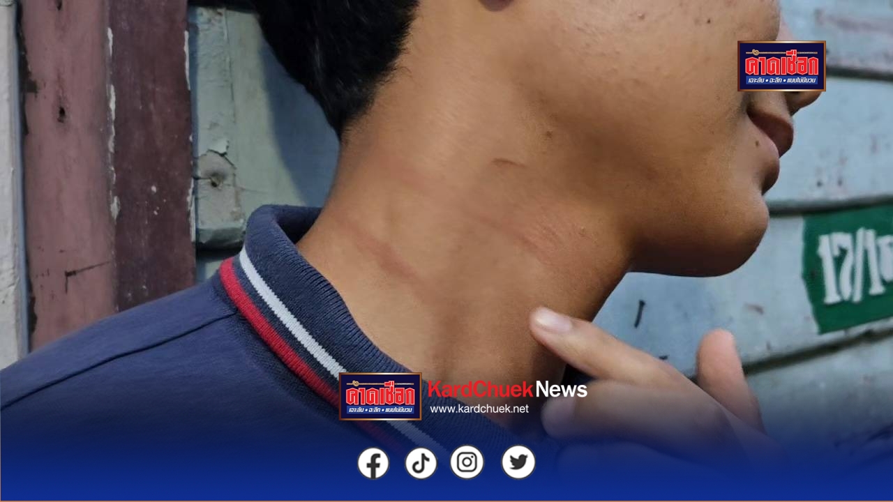 นนทบุรี เจ้าอาวาสโร่แจ้งความ ถูกเด็ก 16 ปี ทำร้ายคิ้วแตก หน้าตาปูดบวม หลังห้ามขุดไส้เดือนในวัด