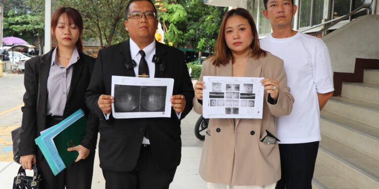  ผู้ปกครองเด็ก 12 ปี แจ้งความโรงเรียนอินเตอร์ชื่อดังย่านวังทองหลาง ลูกชายถูกเพื่อนร่วมห้อง ปาลูกเทนนิสอัดเบ้าตา บาดเจ็บสาหัส หวั่นเป็นต้อหินในอนาคต จี้โรงเรียนรับผิดชอบ 