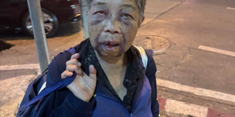 ยายร้องขอชีวิตถูกโจรโหดใช้เท้ากระทืบศอกกระทุ้งหน้าชิงมือถือกระเป๋าเงิน