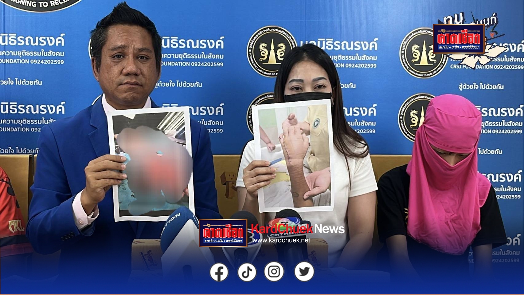 นนทบุรี แม่พาลูกชายวัย 14 ร้องเพจดัง ถูกกลุ่มวัยรุ่นรุมทำร้ายฟันจนฝ่ามือแทบขาด คดีกลับไม่คืบ