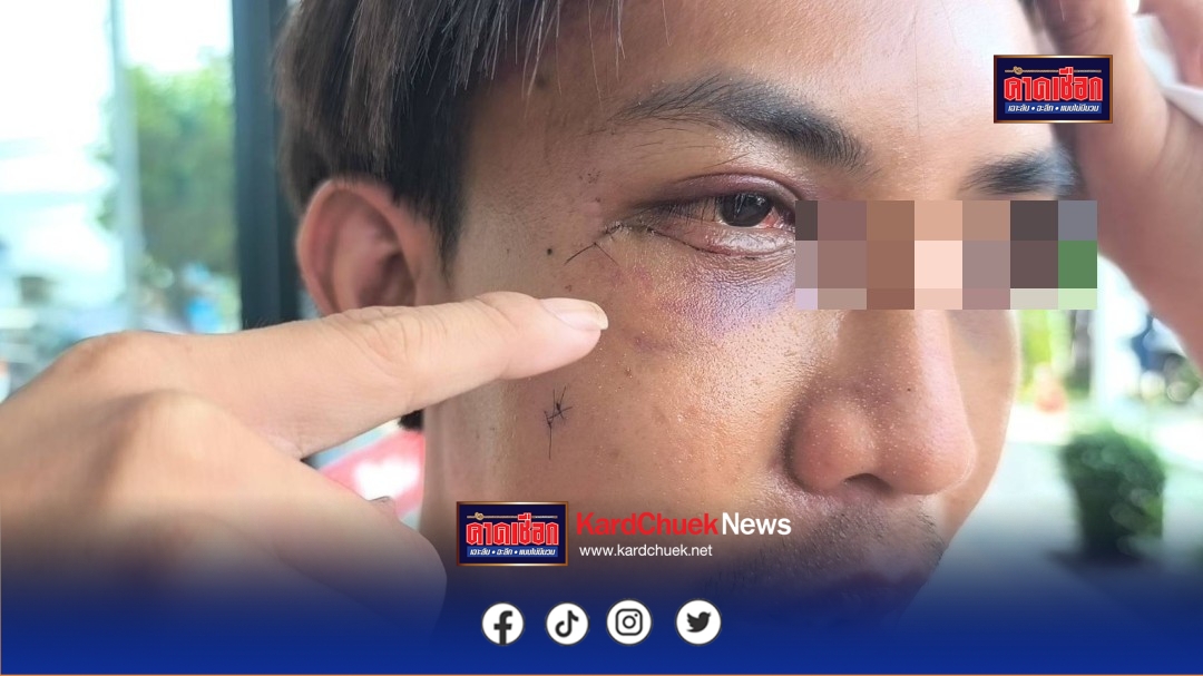 นนทบุรี วงจรปิด หนุ่มวัย26ปี ถูกแฟนเก่าของแฟนสาวยกพวกรุมกระทืบเจ็บสาหัส เผยพึ่งคบกับแฟนสาวแค่2เดือน อ้างบอกโสด 