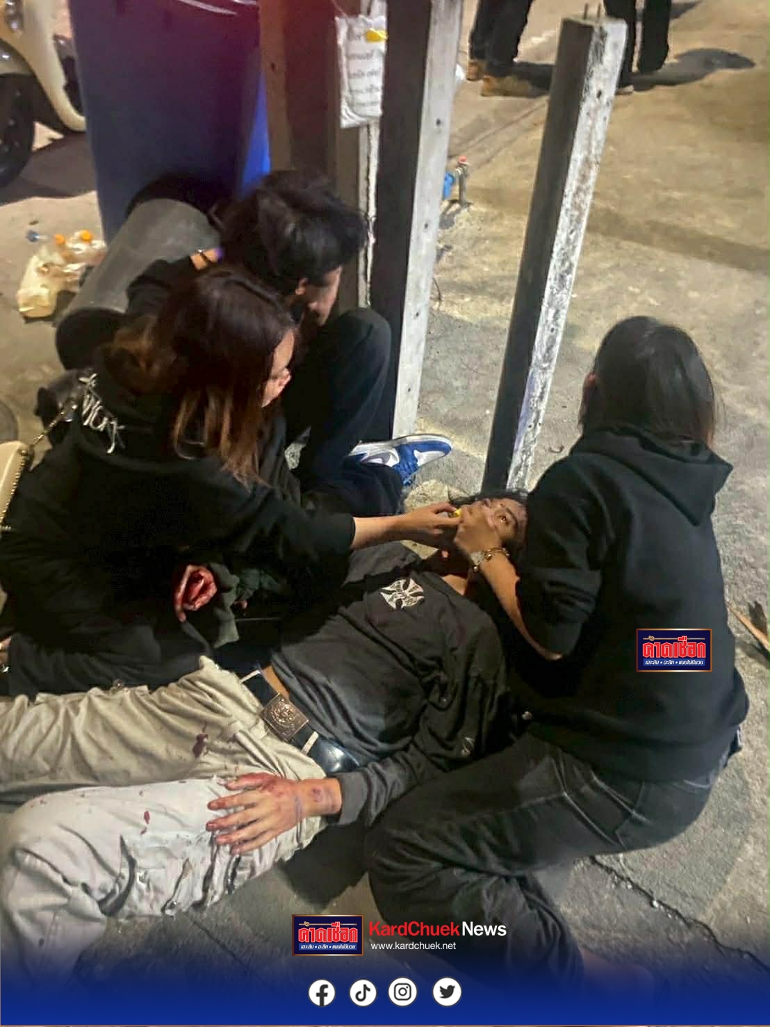 นักศึกษาฝาแฝดถูก 20 โจ๋ใช้มีด–ไม้เบสบอล รุมฟันนิ้วเกือบขาด เหตุแค่มองหน้า คดีเงียบ